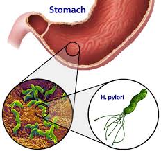 pylori