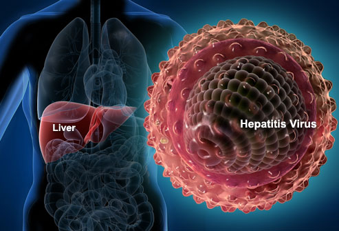 Hepatitis C graphic