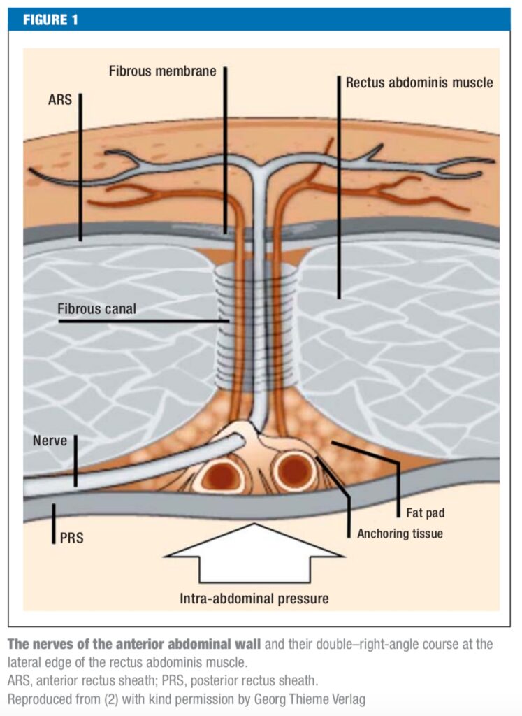 ACNES-2